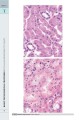 Фото Wheater's Basic Pathology: A Text, Atlas, and Review of Histopathology. International Edition, 5th Edition 9
