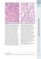 Фото Wheater's Basic Pathology: A Text, Atlas, and Review of Histopathology. International Edition, 5th Edition 12