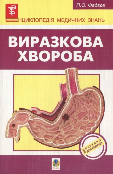 Фото Виразкова хвороба