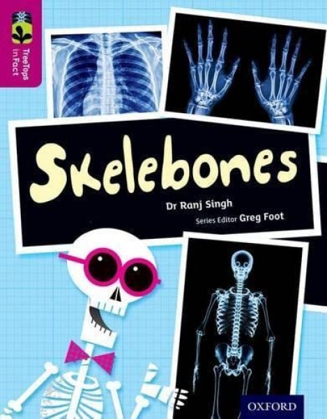 Фото Oxford Reading Tree TreeTops inFact. Level 10: Skelebones
